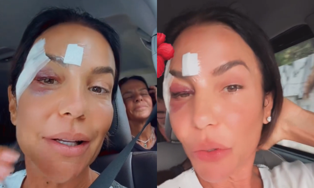 Ivete Sangalo recebe alta de hospital após desmaio