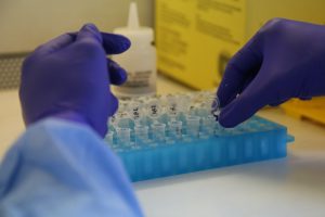 Saúde nega caso confirmado de Mpox em Niterói após boato sobre a doença na cidade
