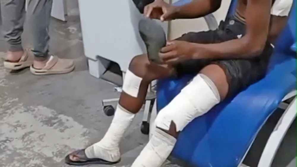 Explosão de bomba caseira em escola; alunos tiveram ferimentos nas pernas, rosto e abdômen 25 08ciep3a 1