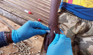 São Gonçalo investiga caso suspeito de MPox