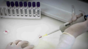 Brasileira que retornou do Congo é monitorada por suspeita de ebola em São Paulo
