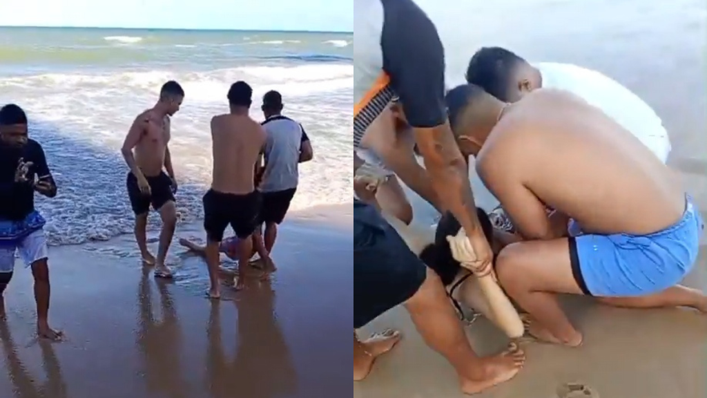 Jovem de 19 anos tem perna amputada após ataque de tubarão em praia do Recife